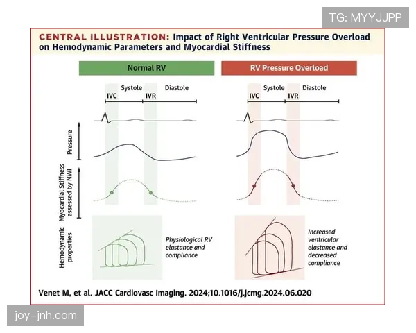 登贝莱天赋兑现率与生涯发展曲线评估